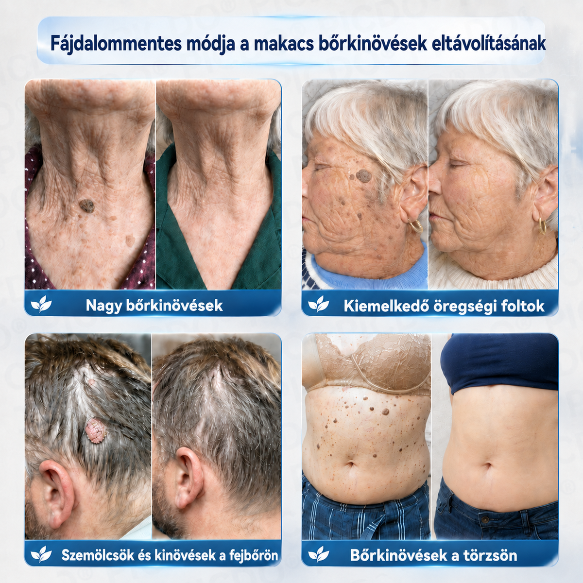 🌿🌿PuraCure® 𝟕 𝐍𝐚𝐩𝐨𝐬 𝐊𝐫é𝐦 𝐁ő𝐫𝐟ü𝐠𝐠𝐞𝐥é𝐤𝐞𝐤 é𝐬 𝐏𝐢𝐠𝐦𝐞𝐧𝐭𝐟𝐨𝐥𝐭𝐨𝐤 𝐄𝐥𝐥𝐞𝐧 (𝐅á𝐣𝐝𝐚𝐥𝐨𝐦𝐦𝐞𝐧𝐭𝐞𝐬 𝐅𝐨𝐫𝐦𝐮𝐥𝐚 – 𝐇𝐞𝐠𝐞𝐤 𝐍é𝐥𝐤ü𝐥)🍁