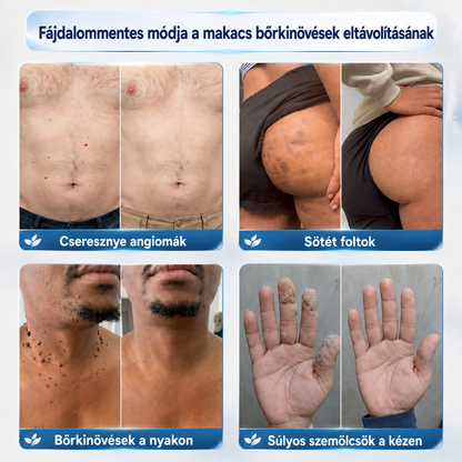 🌿🌿PuraCure® 𝟕 𝐍𝐚𝐩𝐨𝐬 𝐊𝐫é𝐦 𝐁ő𝐫𝐟ü𝐠𝐠𝐞𝐥é𝐤𝐞𝐤 é𝐬 𝐏𝐢𝐠𝐦𝐞𝐧𝐭𝐟𝐨𝐥𝐭𝐨𝐤 𝐄𝐥𝐥𝐞𝐧 (𝐅á𝐣𝐝𝐚𝐥𝐨𝐦𝐦𝐞𝐧𝐭𝐞𝐬 𝐅𝐨𝐫𝐦𝐮𝐥𝐚 – 𝐇𝐞𝐠𝐞𝐤 𝐍é𝐥𝐤ü𝐥)🍁