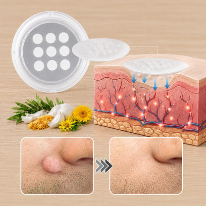 🌿𝐏𝐮𝐫𝐚𝐂𝐮𝐫𝐞® 𝟐 𝐚𝐳 𝟏-𝐛𝐞𝐧 𝐦𝐢𝐤𝐫𝐨𝐭ű𝐬 é𝐬 𝐡𝐢𝐝𝐫𝐨𝐤𝐨𝐥𝐥𝐨𝐢𝐝 𝐭𝐚𝐩𝐚𝐬𝐳🍀 | 𝐊𝐢á𝐥𝐥ó 𝐚𝐧𝐲𝐚𝐣𝐞𝐠𝐲𝐞𝐤, 𝐚𝐤𝐧é𝐤, 𝐥𝐚𝐩𝐨𝐬 𝐬𝐳𝐞𝐦ö𝐥𝐜𝐬ö𝐤 é𝐬 𝐛ő𝐫𝐧ö𝐯𝐞𝐝é𝐤𝐞𝐤 𝐞𝐥𝐭á𝐯𝐨𝐥í𝐭á𝐬á𝐫𝐚 | 𝐒𝐞𝐠í𝐭 𝐜𝐬ö𝐤𝐤𝐞𝐧𝐭𝐞𝐧𝐢 𝐚 𝐫á𝐧𝐜𝐨𝐤𝐚𝐭, 𝐡𝐞𝐠𝐞𝐤𝐞𝐭 é𝐬 𝐛ő𝐫𝐡𝐢𝐛á𝐤𝐚𝐭 | 𝐋á𝐭𝐡𝐚𝐭𝐚𝐭𝐥𝐚𝐧 𝐭𝐚𝐩𝐚𝐬𝐳 𝐚𝐳 𝐚𝐫𝐜𝐫𝐚 é𝐬 𝐭𝐞𝐬𝐭𝐫𝐞