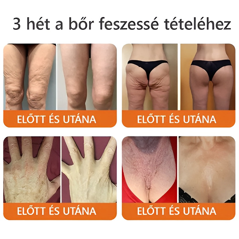 ✨✨ ZödVita® Méhméreg Bőr Helyreállító Krém 🔥 Természetes Öregedésgátló, Feszesíti a Bőrt, Csökkenti a Ráncokat– 50ml