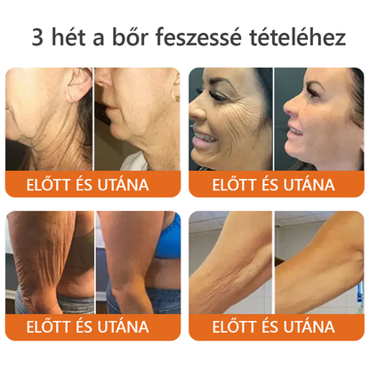 ✨✨ ZödVita® Méhméreg Bőr Helyreállító Krém 🔥 Természetes Öregedésgátló, Feszesíti a Bőrt, Csökkenti a Ráncokat– 50ml