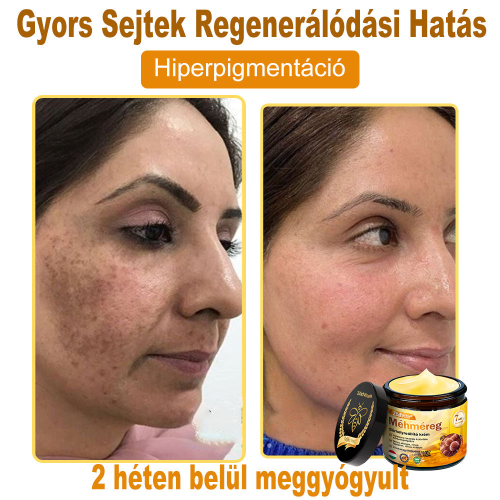 🍃 Bőrgyógyász ajánlása ✨ ZödVita® Méhméreg Bőr Helyreállító Krém 🔥 Magyar fejlesztés, magyarországi gyártás és szállítás
