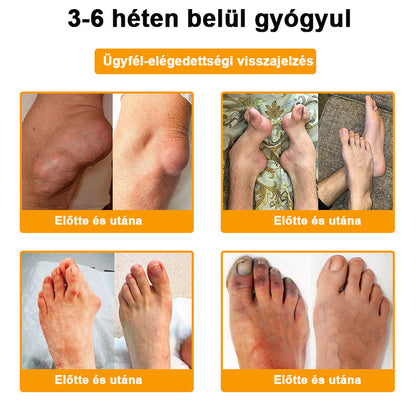 🟢 𝑺𝒕𝒂𝒘𝑽𝒊𝒕𝒂𝒍® Botoxot és Méhmérget Tartalmazó Regeneráló Krém Ízületekre és Csontokra |✨ MOT (Magyar Ortopéd Társaság) által tanúsított termék