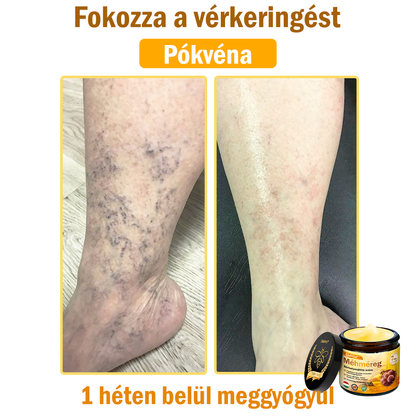 💧💧Bőrgyógyász ajánlása💪ZödVita® Méhméreg Bőrhelyreállító Krém (👨‍⚕‍CE jóváhagyott)👍✅