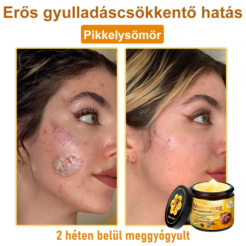 🌿𝐏𝐮𝐫𝐚𝐂𝐮𝐫𝐞® 𝐌é𝐡𝐦é𝐫𝐞𝐠 𝐁ő𝐫 𝐇𝐞𝐥𝐲𝐫𝐞á𝐥𝐥í𝐭ó 𝐊𝐫é𝐦 (𝐂𝐄 𝐓𝐚𝐧ú𝐬í𝐭𝐯á𝐧𝐲)👍✅