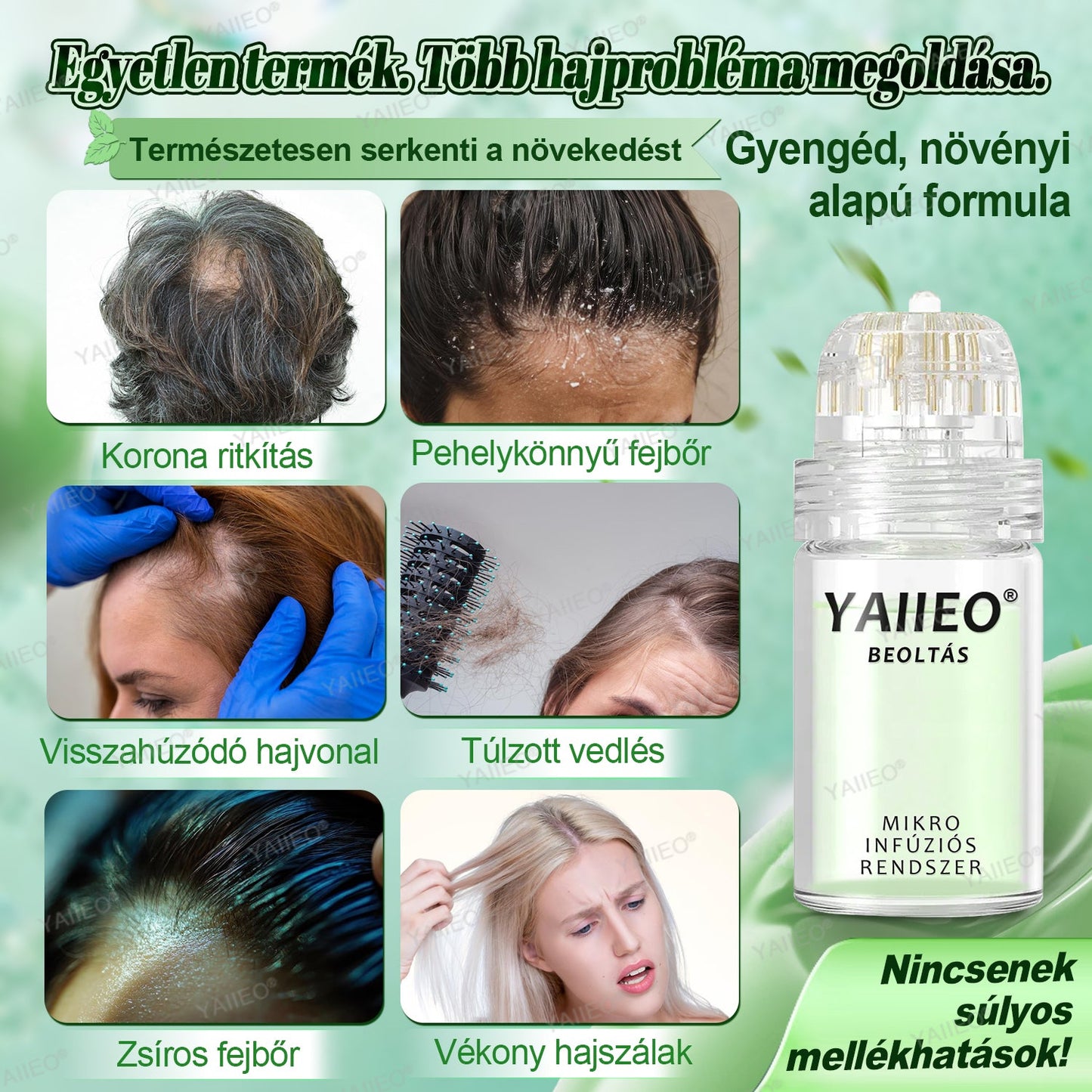🍎🍎YAIIEO® 𝑭á𝒋𝒅𝒂𝒍𝒐𝒎𝒎𝒆𝒏𝒕𝒆𝒔 𝑴𝒊𝒌𝒓𝒐𝒊𝒏𝒇ú𝒛𝒊ó𝒔 𝑹𝒆𝒏𝒅𝒔𝒛𝒆𝒓 Mélyen ható DHT-blokkolás, hajhagymák újraaktiválása és látható hajnövekedés