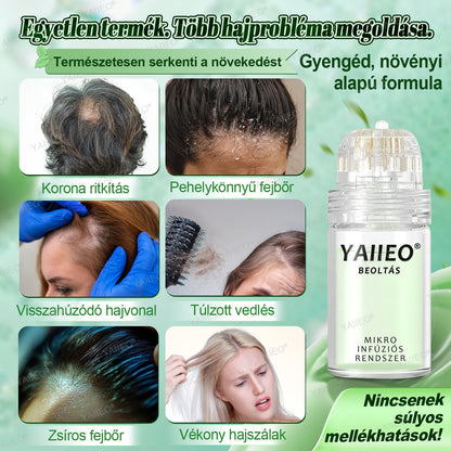 🍎🍎YAIIEO® 𝑭á𝒋𝒅𝒂𝒍𝒐𝒎𝒎𝒆𝒏𝒕𝒆𝒔 𝑴𝒊𝒌𝒓𝒐𝒊𝒏𝒇ú𝒛𝒊ó𝒔 𝑹𝒆𝒏𝒅𝒔𝒛𝒆𝒓 Mélyen ható DHT-blokkolás, hajhagymák újraaktiválása és látható hajnövekedés