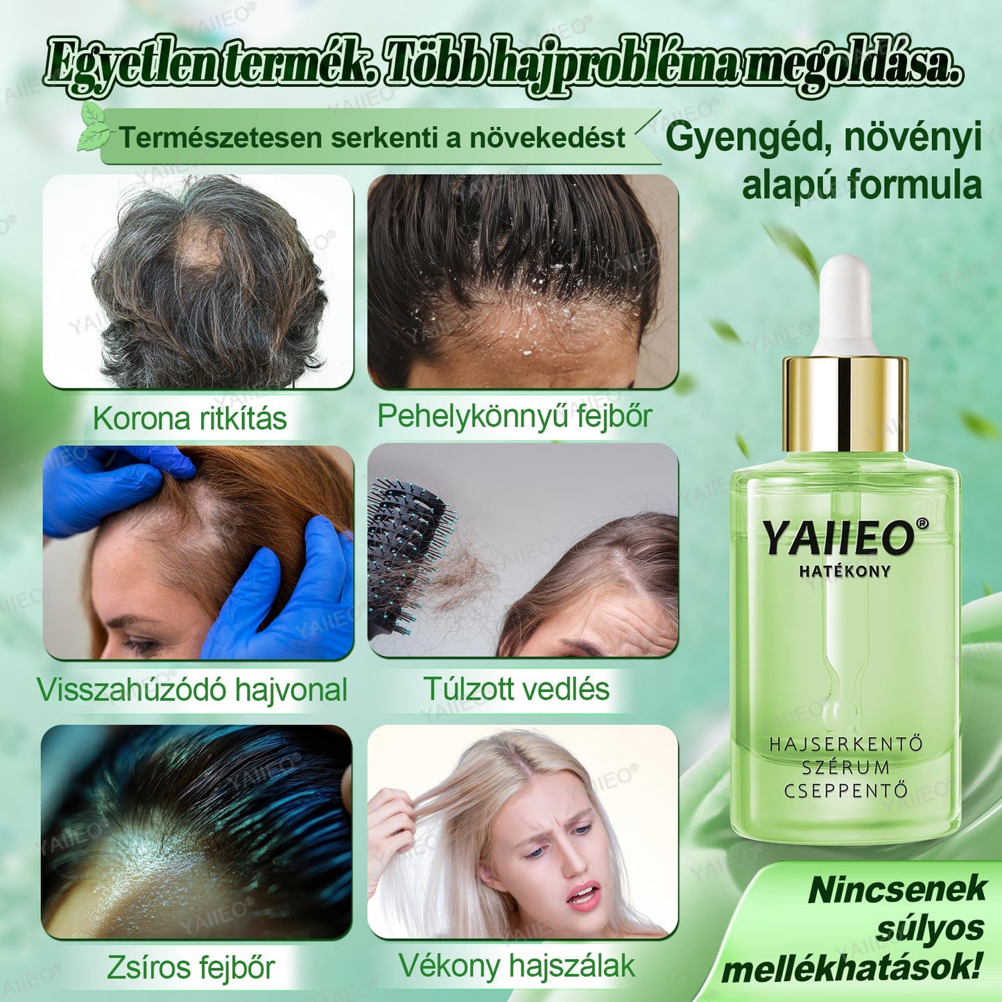 🍌🍌𝒀𝑨𝑰𝑰𝑬𝑶® 𝑯𝒂𝒋𝒔𝒆𝒓𝒌𝒆𝒏𝒕ő 𝑺𝒛é𝒓𝒖𝒎 – 𝑭á𝒋𝒅𝒂𝒍𝒐𝒎𝒎𝒆𝒏𝒕𝒆𝒔 𝑯𝒂𝒋á𝒑𝒐𝒍á𝒔