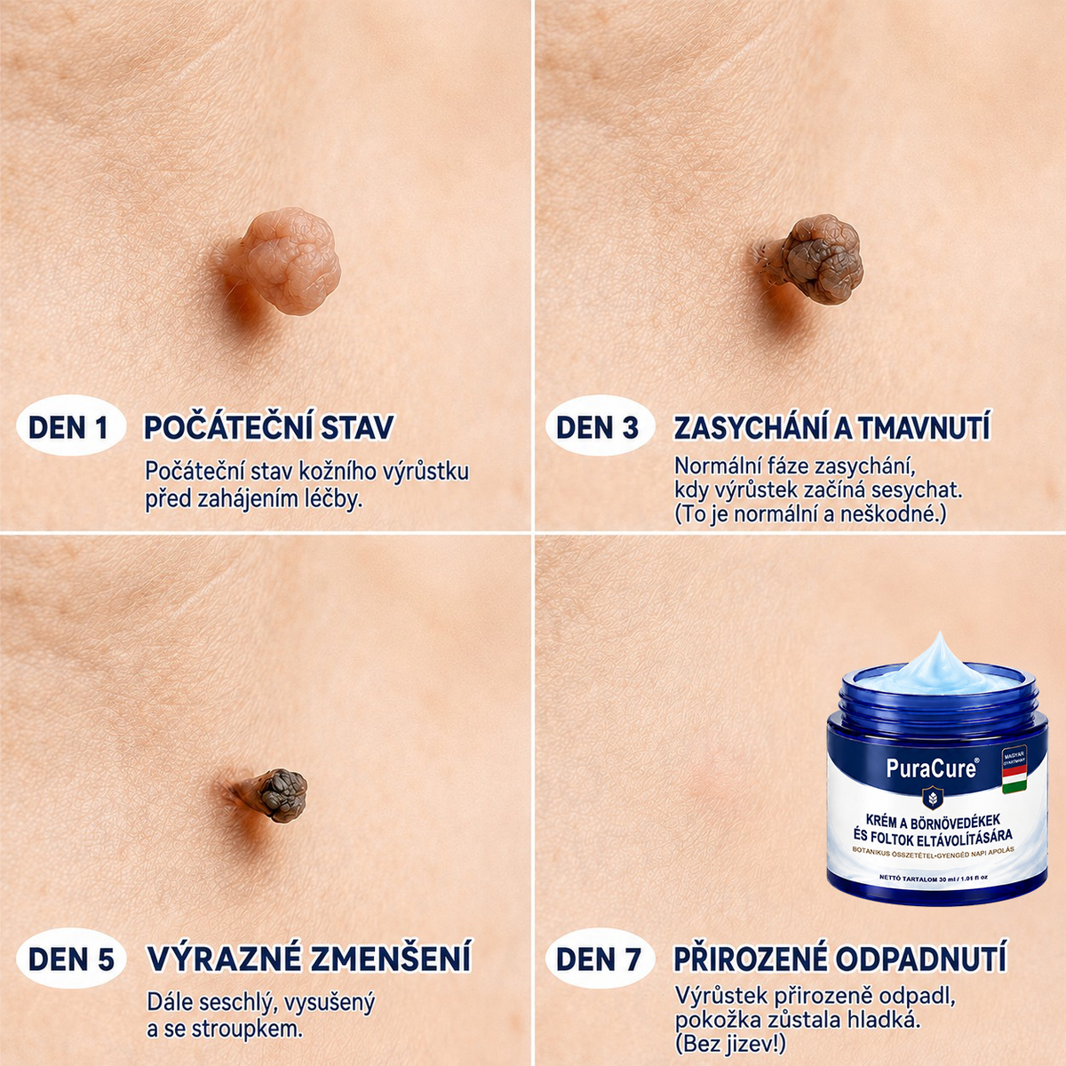 🌿🌿PuraCure® 𝟕 𝐍𝐚𝐩𝐨𝐬 𝐊𝐫é𝐦 𝐁ő𝐫𝐟ü𝐠𝐠𝐞𝐥é𝐤𝐞𝐤 é𝐬 𝐏𝐢𝐠𝐦𝐞𝐧𝐭𝐟𝐨𝐥𝐭𝐨𝐤 𝐄𝐥𝐥𝐞𝐧 (𝐅á𝐣𝐝𝐚𝐥𝐨𝐦𝐦𝐞𝐧𝐭𝐞𝐬 𝐅𝐨𝐫𝐦𝐮𝐥𝐚 – 𝐇𝐞𝐠𝐞𝐤 𝐍é𝐥𝐤ü𝐥)🍁
