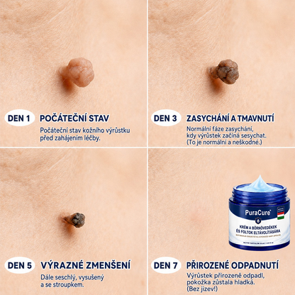 🌿🌿PuraCure® 𝟕 𝐍𝐚𝐩𝐨𝐬 𝐊𝐫é𝐦 𝐁ő𝐫𝐟ü𝐠𝐠𝐞𝐥é𝐤𝐞𝐤 é𝐬 𝐏𝐢𝐠𝐦𝐞𝐧𝐭𝐟𝐨𝐥𝐭𝐨𝐤 𝐄𝐥𝐥𝐞𝐧 (𝐅á𝐣𝐝𝐚𝐥𝐨𝐦𝐦𝐞𝐧𝐭𝐞𝐬 𝐅𝐨𝐫𝐦𝐮𝐥𝐚 – 𝐇𝐞𝐠𝐞𝐤 𝐍é𝐥𝐤ü𝐥)🍁
