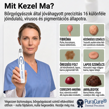 🌿𝐏𝐮𝐫𝐚𝐂𝐮𝐫𝐞® 👩‍⚕️ 𝟕 𝐍𝐚𝐩𝐨𝐬 Bőrkinövés- és Folteltávolító Toll Fájdalommentes és Hegmentes Professzionális Rollerball