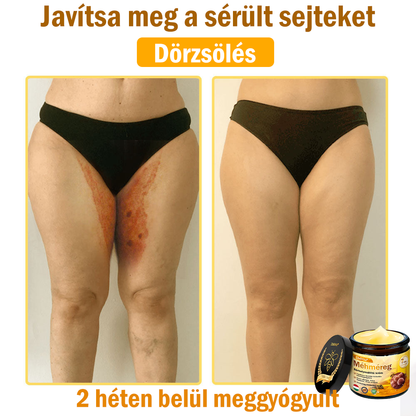 💧💧Bőrgyógyász ajánlása💪ZödVita® Méhméreg Bőrhelyreállító Krém (👨‍⚕‍CE jóváhagyott)👍✅