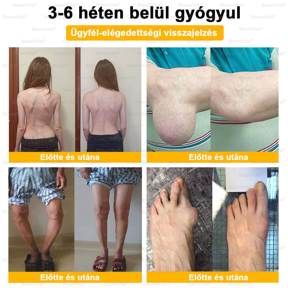 🟢 𝑺𝒕𝒂𝒘𝑽𝒊𝒕𝒂𝒍® Botoxot és Méhmérget Tartalmazó Regeneráló Krém Ízületekre és Csontokra |✨ MOT (Magyar Ortopéd Társaság) által tanúsított termék