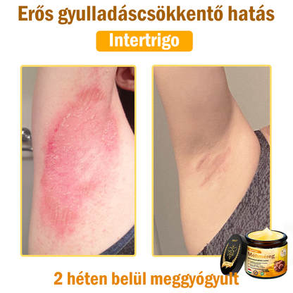 💧💧Bőrgyógyász ajánlása💪ZödVita® Méhméreg Bőrhelyreállító Krém (👨‍⚕‍CE jóváhagyott)👍✅