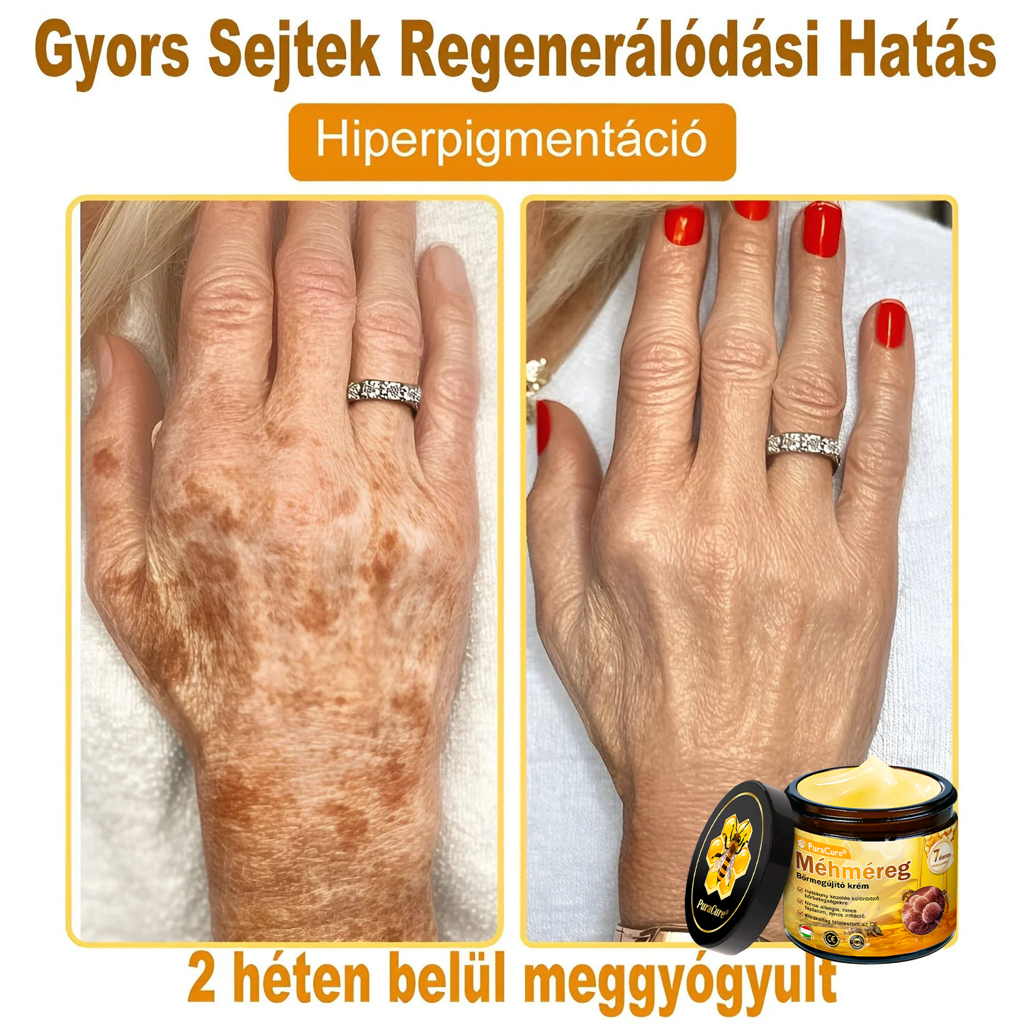 🌿𝐏𝐮𝐫𝐚𝐂𝐮𝐫𝐞® 𝐌é𝐡𝐦é𝐫𝐞𝐠 𝐁ő𝐫 𝐇𝐞𝐥𝐲𝐫𝐞á𝐥𝐥í𝐭ó 𝐊𝐫é𝐦 (𝐂𝐄 𝐓𝐚𝐧ú𝐬í𝐭𝐯á𝐧𝐲)👍✅