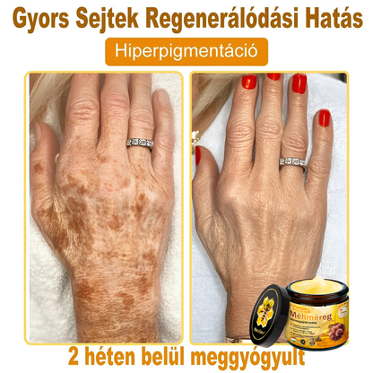 🌿𝐏𝐮𝐫𝐚𝐂𝐮𝐫𝐞® 𝐌é𝐡𝐦é𝐫𝐞𝐠 𝐁ő𝐫 𝐇𝐞𝐥𝐲𝐫𝐞á𝐥𝐥í𝐭ó 𝐊𝐫é𝐦 (𝐂𝐄 𝐓𝐚𝐧ú𝐬í𝐭𝐯á𝐧𝐲)👍✅