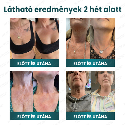 🌿 NORUION® Q10 x Növényi Nano Exoszóma Haladó Ránctalanító Krém