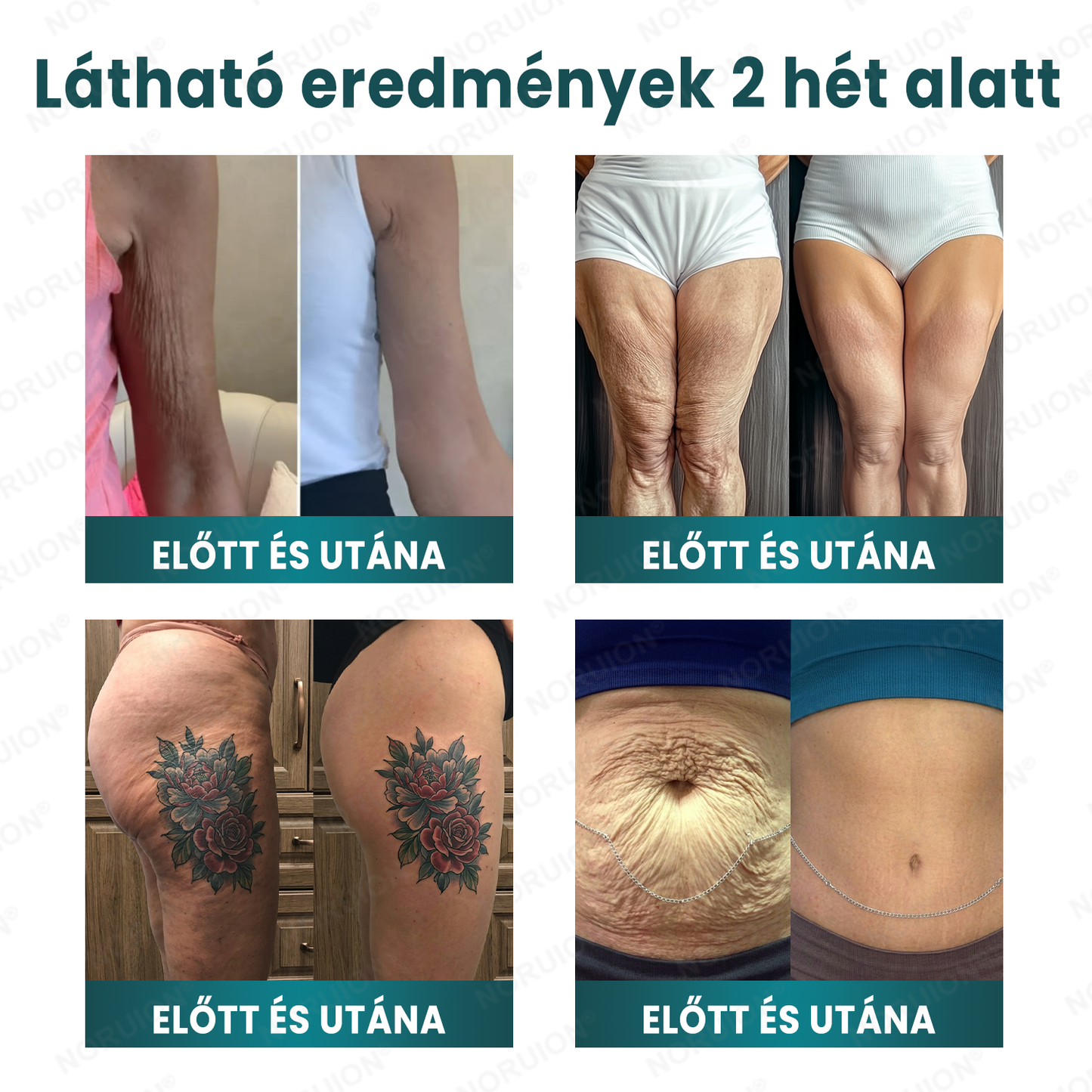 🌿 NORUION® Q10 x Növényi Nano Exoszóma Haladó Ránctalanító Krém