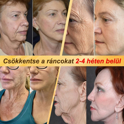 ✨PuraCure® TÖBBFÉLE BŐRPROBLÉMÁRA HATÓ MÉHMÉREG MIKROTŰS BŐRREGENERÁLÓ TAPASZOK