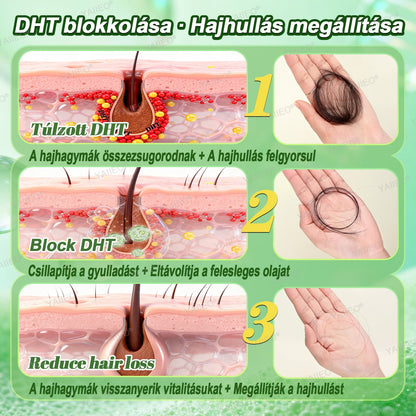 🍌🍌𝒀𝑨𝑰𝑰𝑬𝑶® 𝑯𝒂𝒋𝒔𝒆𝒓𝒌𝒆𝒏𝒕ő 𝑺𝒛é𝒓𝒖𝒎 – 𝑭á𝒋𝒅𝒂𝒍𝒐𝒎𝒎𝒆𝒏𝒕𝒆𝒔 𝑯𝒂𝒋á𝒑𝒐𝒍á𝒔