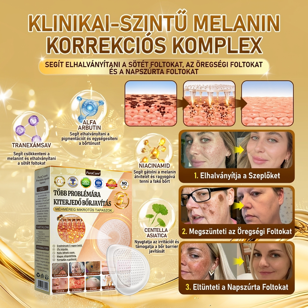 ✨PuraCure® TÖBBFÉLE BŐRPROBLÉMÁRA HATÓ MÉHMÉREG MIKROTŰS BŐRREGENERÁLÓ TAPASZOK