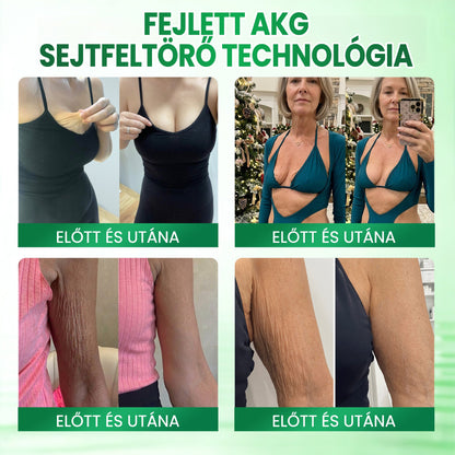 🌼🌼Medistart® AKG BŐRFESZESÍTŐ & ÖREGEDÉS ELLENI ÁPOLÁS