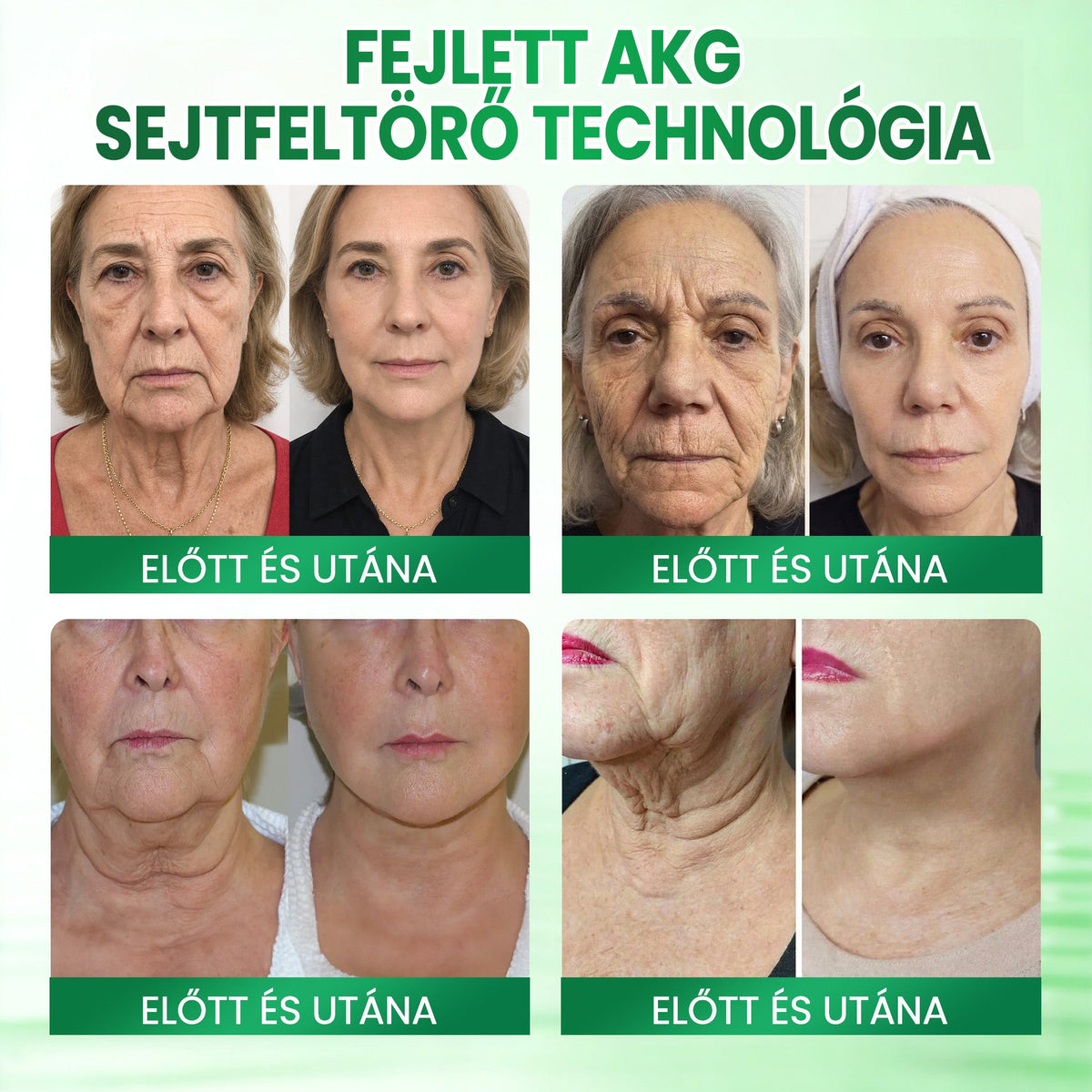 🌼🌼Medistart® AKG BŐRFESZESÍTŐ & ÖREGEDÉS ELLENI ÁPOLÁS