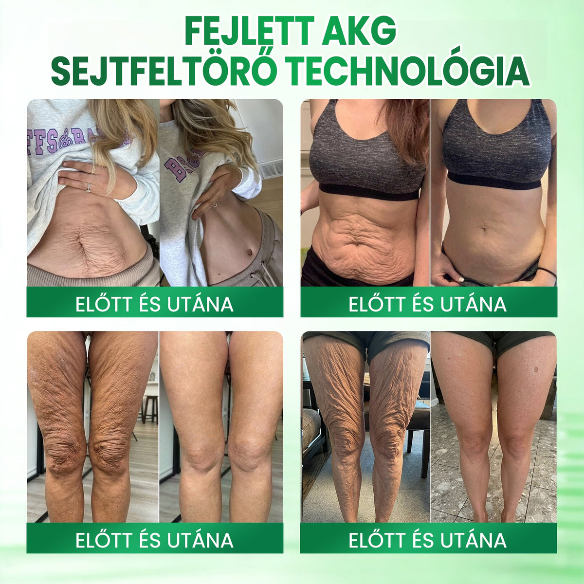 🌼🌼Medistart® AKG BŐRFESZESÍTŐ & ÖREGEDÉS ELLENI ÁPOLÁS