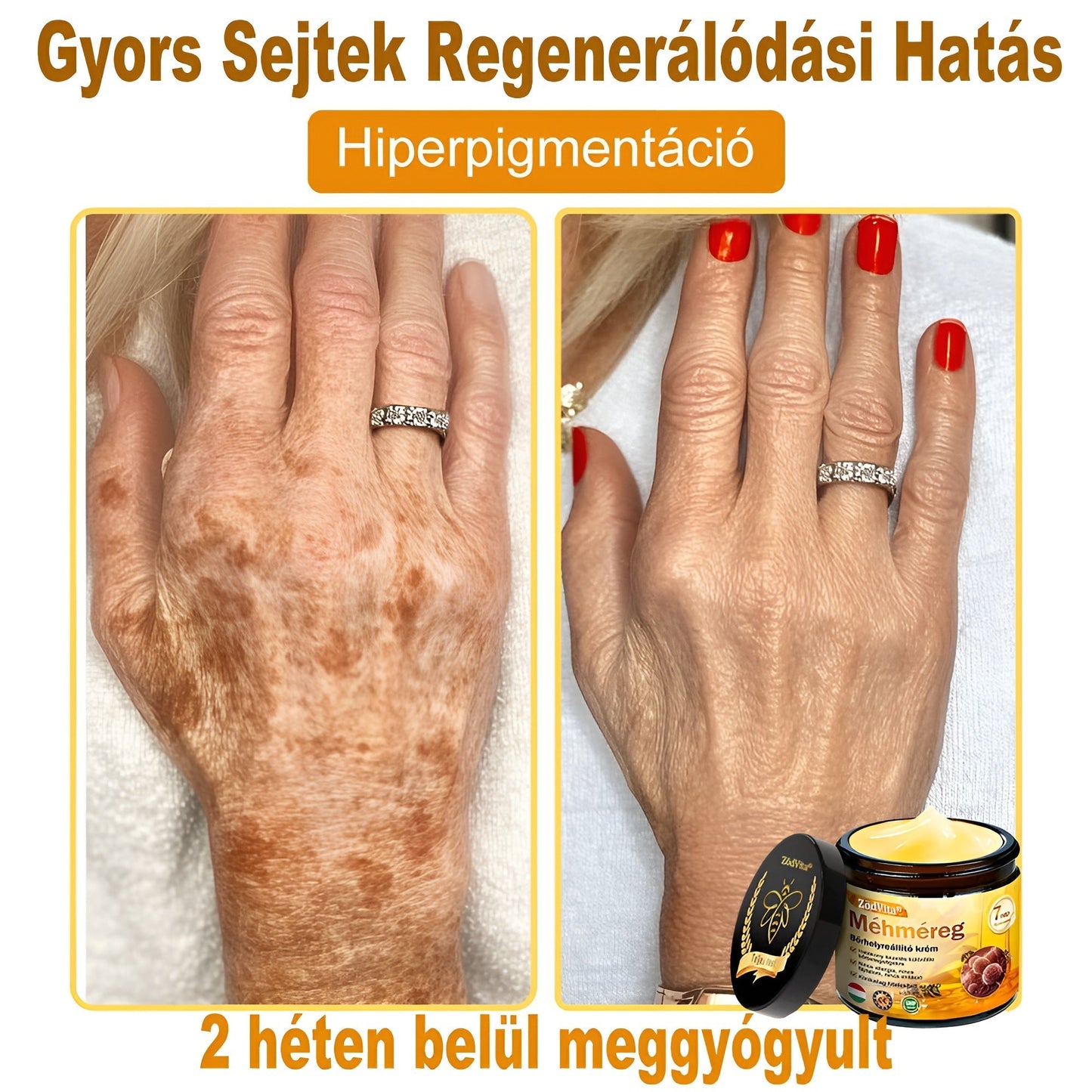 ✨✨ ZödVita® Méhméreg Bőr Helyreállító Krém 🔥 Természetes Öregedésgátló, Feszesíti a Bőrt, Csökkenti a Ráncokat– 50ml