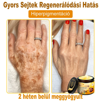 ✨✨ ZödVita® Méhméreg Bőr Helyreállító Krém 🔥 Természetes Öregedésgátló, Feszesíti a Bőrt, Csökkenti a Ráncokat– 50ml