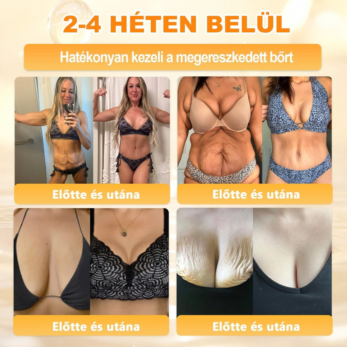 🐝🐝🐝 𝖠𝖯𝖪𝖠𝖯𝖪® Méhméreg Bőr Helyreállító Krém 🔥 Magyar fejlesztés, magyarországi gyártás és szállítás