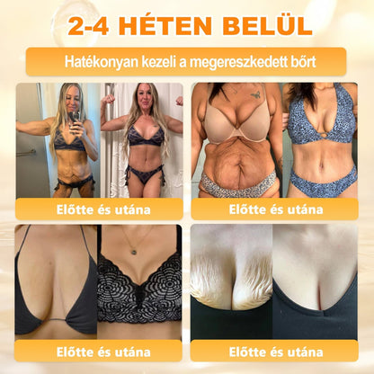 🌿𝐏𝐮𝐫𝐚𝐂𝐮𝐫𝐞® 𝐌é𝐡𝐦é𝐫𝐞𝐠 𝐁ő𝐫 𝐇𝐞𝐥𝐲𝐫𝐞á𝐥𝐥í𝐭ó 𝐊𝐫é𝐦 (𝐂𝐄 𝐓𝐚𝐧ú𝐬í𝐭𝐯á𝐧𝐲)👍✅