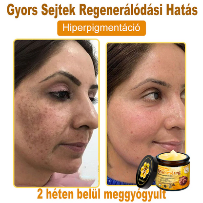 🌿𝐏𝐮𝐫𝐚𝐂𝐮𝐫𝐞® 𝐌é𝐡𝐦é𝐫𝐞𝐠 𝐁ő𝐫 𝐇𝐞𝐥𝐲𝐫𝐞á𝐥𝐥í𝐭ó 𝐊𝐫é𝐦 (𝐂𝐄 𝐓𝐚𝐧ú𝐬í𝐭𝐯á𝐧𝐲)👍✅