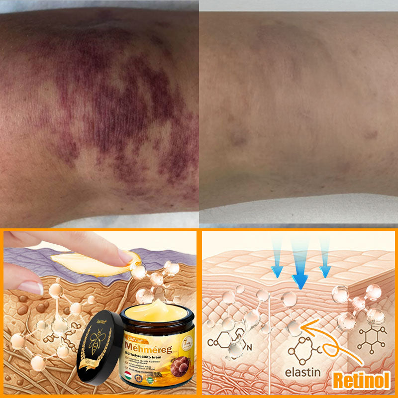 🍀Bőrgyógyász ajánlása 💪 ZödVita® Méhméreg Bőr Helyreállító Krém 🔥 Magyar fejlesztés, magyarországi gyártás és szállítás🌿