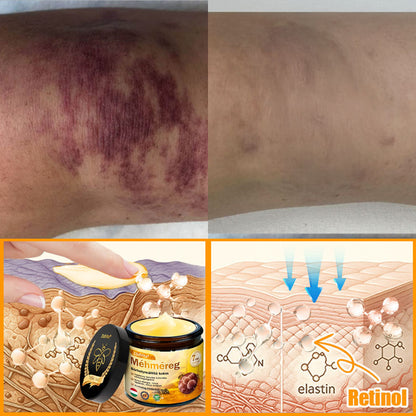 🍀Bőrgyógyász ajánlása 💪 ZödVita® Méhméreg Bőr Helyreállító Krém 🔥 Magyar fejlesztés, magyarországi gyártás és szállítás🌿