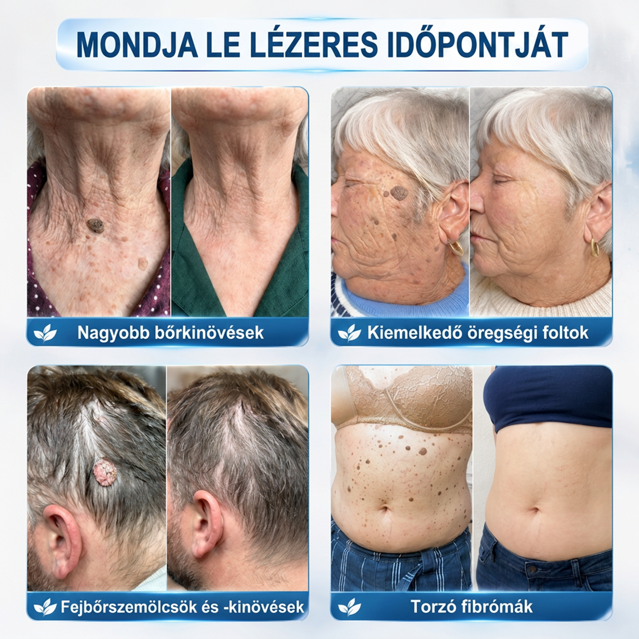 🌿𝐏𝐮𝐫𝐚𝐂𝐮𝐫𝐞® 👩‍⚕️ 𝟕 𝐍𝐚𝐩𝐨𝐬 Bőrkinövés- és Folteltávolító Toll Fájdalommentes és Hegmentes Professzionális Rollerball