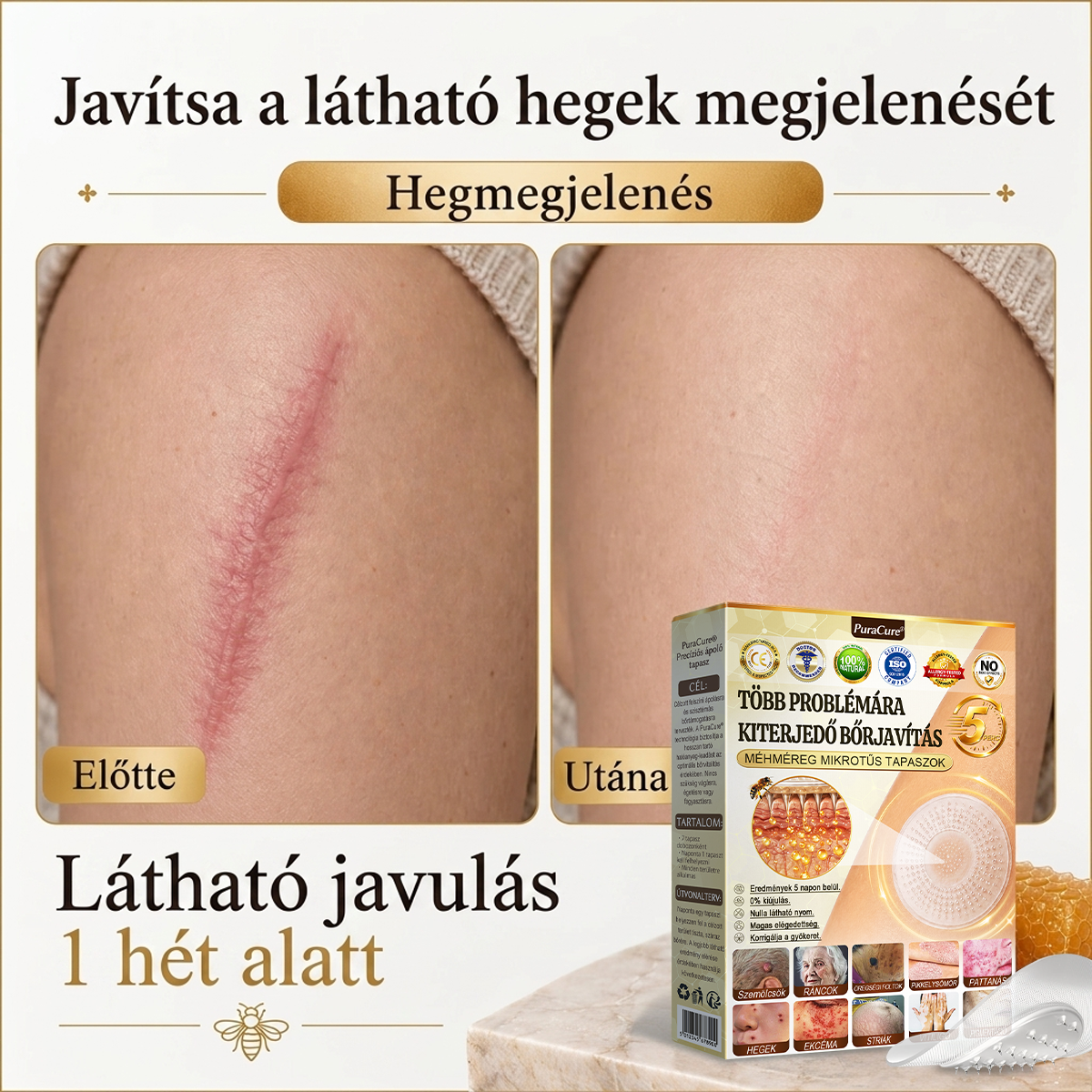 ✨PuraCure® TÖBBFÉLE BŐRPROBLÉMÁRA HATÓ MÉHMÉREG MIKROTŰS BŐRREGENERÁLÓ TAPASZOK
