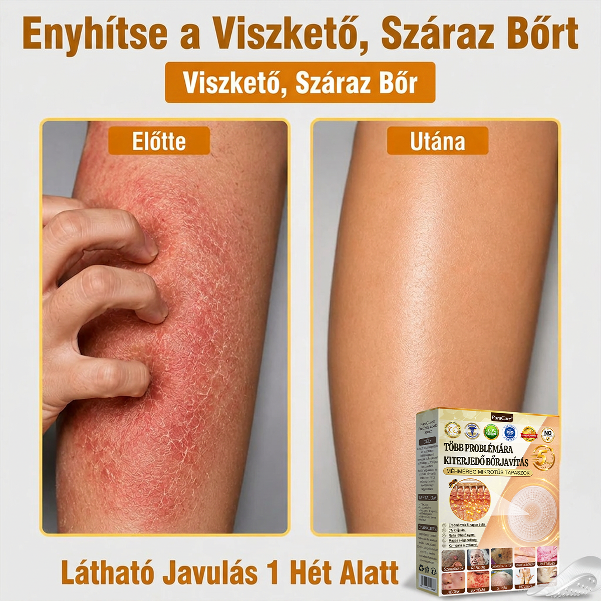 ✨PuraCure® TÖBBFÉLE BŐRPROBLÉMÁRA HATÓ MÉHMÉREG MIKROTŰS BŐRREGENERÁLÓ TAPASZOK