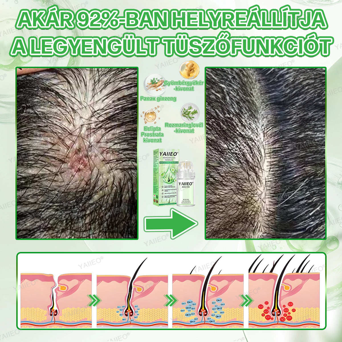 🍎🍎YAIIEO® 𝑭á𝒋𝒅𝒂𝒍𝒐𝒎𝒎𝒆𝒏𝒕𝒆𝒔 𝑴𝒊𝒌𝒓𝒐𝒊𝒏𝒇ú𝒛𝒊ó𝒔 𝑹𝒆𝒏𝒅𝒔𝒛𝒆𝒓 Mélyen ható DHT-blokkolás, hajhagymák újraaktiválása és látható hajnövekedés