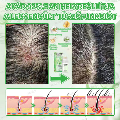 🍎🍎YAIIEO® 𝑭á𝒋𝒅𝒂𝒍𝒐𝒎𝒎𝒆𝒏𝒕𝒆𝒔 𝑴𝒊𝒌𝒓𝒐𝒊𝒏𝒇ú𝒛𝒊ó𝒔 𝑹𝒆𝒏𝒅𝒔𝒛𝒆𝒓 Mélyen ható DHT-blokkolás, hajhagymák újraaktiválása és látható hajnövekedés