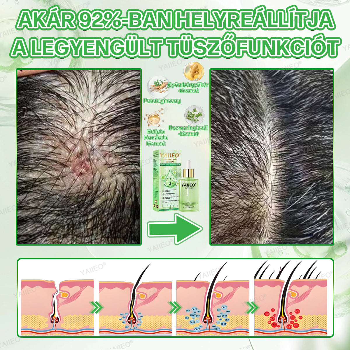 𝒀𝑨𝑰𝑰𝑬𝑶® 𝑯𝒂𝒋𝒔𝒆𝒓𝒌𝒆𝒏𝒕ő 𝑺𝒛é𝒓𝒖𝒎 – 𝑭á𝒋𝒅𝒂𝒍𝒐𝒎𝒎𝒆𝒏𝒕𝒆𝒔 𝑯𝒂𝒋á𝒑𝒐𝒍á𝒔