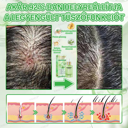 𝒀𝑨𝑰𝑰𝑬𝑶® 𝑯𝒂𝒋𝒔𝒆𝒓𝒌𝒆𝒏𝒕ő 𝑺𝒛é𝒓𝒖𝒎 – 𝑭á𝒋𝒅𝒂𝒍𝒐𝒎𝒎𝒆𝒏𝒕𝒆𝒔 𝑯𝒂𝒋á𝒑𝒐𝒍á𝒔