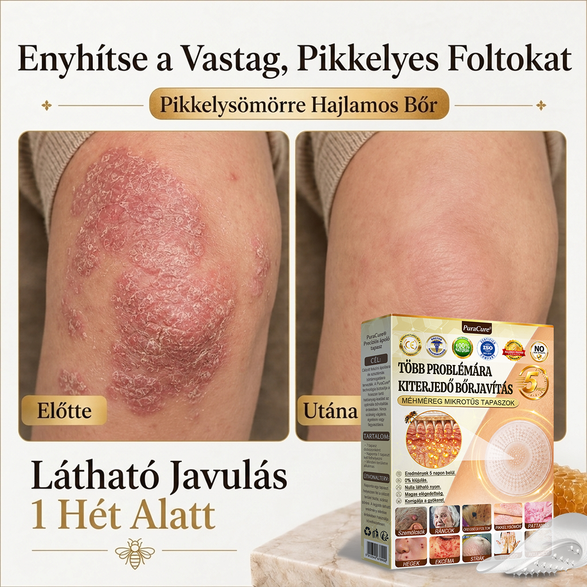 ✨PuraCure® TÖBBFÉLE BŐRPROBLÉMÁRA HATÓ MÉHMÉREG MIKROTŰS BŐRREGENERÁLÓ TAPASZOK