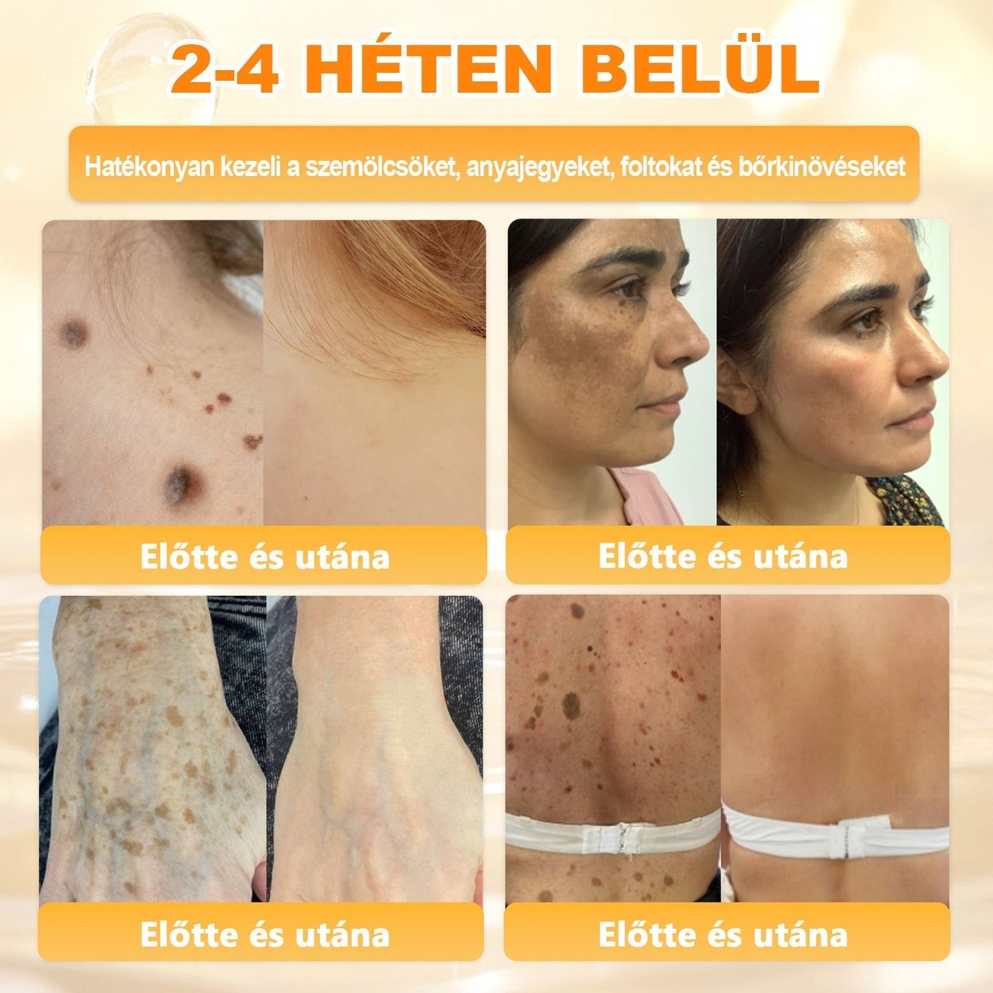 🌿𝐏𝐮𝐫𝐚𝐂𝐮𝐫𝐞® 𝐌é𝐡𝐦é𝐫𝐞𝐠 𝐁ő𝐫 𝐇𝐞𝐥𝐲𝐫𝐞á𝐥𝐥í𝐭ó 𝐊𝐫é𝐦 (𝐂𝐄 𝐓𝐚𝐧ú𝐬í𝐭𝐯á𝐧𝐲)👍✅
