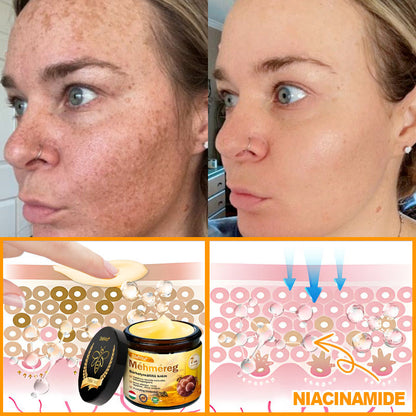 🍀Bőrgyógyász ajánlása 💪 ZödVita® Méhméreg Bőr Helyreállító Krém 🔥 Magyar fejlesztés, magyarországi gyártás és szállítás🌿