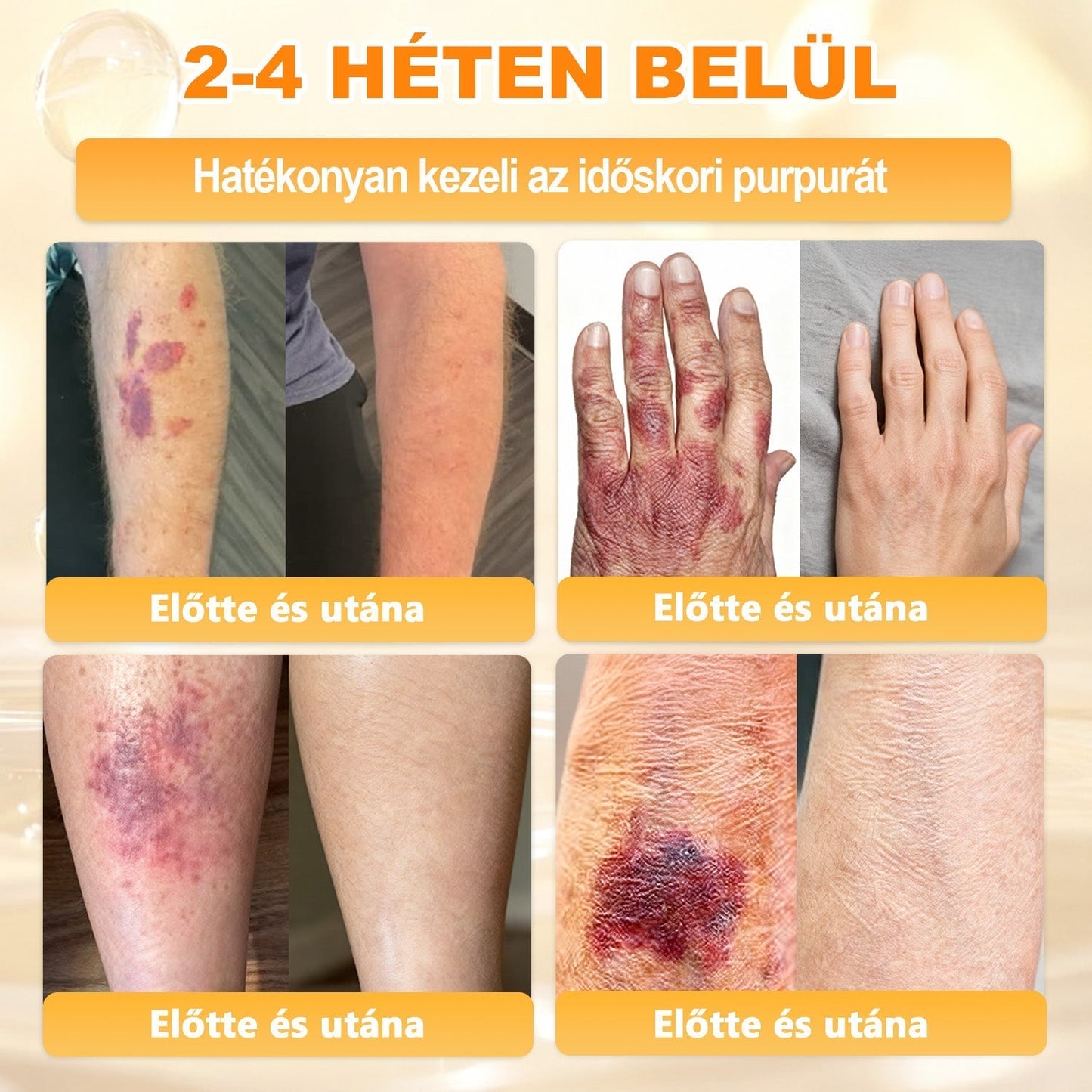 🌿𝐏𝐮𝐫𝐚𝐂𝐮𝐫𝐞® 𝐌é𝐡𝐦é𝐫𝐞𝐠 𝐁ő𝐫 𝐇𝐞𝐥𝐲𝐫𝐞á𝐥𝐥í𝐭ó 𝐊𝐫é𝐦 (𝐂𝐄 𝐓𝐚𝐧ú𝐬í𝐭𝐯á𝐧𝐲)👍✅