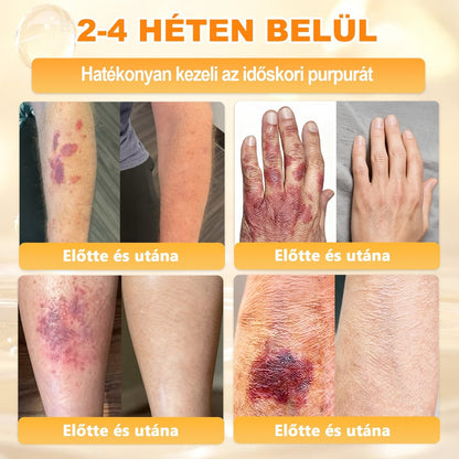 🌿𝐏𝐮𝐫𝐚𝐂𝐮𝐫𝐞® 𝐌é𝐡𝐦é𝐫𝐞𝐠 𝐁ő𝐫 𝐇𝐞𝐥𝐲𝐫𝐞á𝐥𝐥í𝐭ó 𝐊𝐫é𝐦 (𝐂𝐄 𝐓𝐚𝐧ú𝐬í𝐭𝐯á𝐧𝐲)👍✅