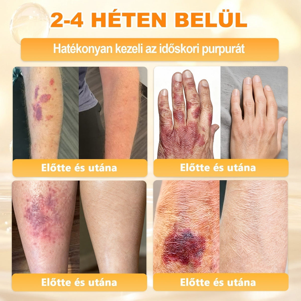 🐝🐝🐝 𝖠𝖯𝖪𝖠𝖯𝖪® Méhméreg Bőr Helyreállító Krém 🔥 Magyar fejlesztés, magyarországi gyártás és szállítás