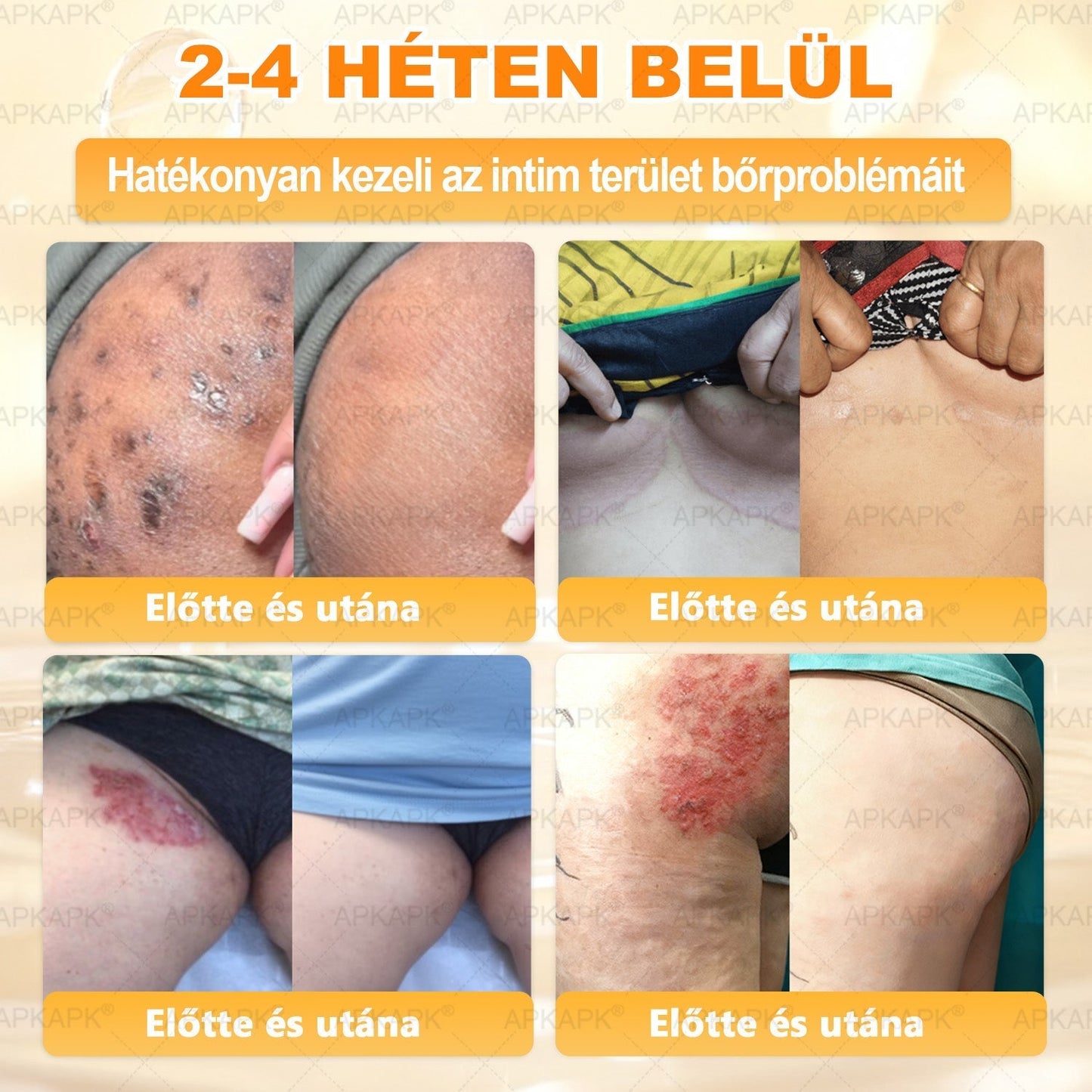 🌿𝐏𝐮𝐫𝐚𝐂𝐮𝐫𝐞® 𝐌é𝐡𝐦é𝐫𝐞𝐠 𝐁ő𝐫 𝐇𝐞𝐥𝐲𝐫𝐞á𝐥𝐥í𝐭ó 𝐊𝐫é𝐦 (𝐂𝐄 𝐓𝐚𝐧ú𝐬í𝐭𝐯á𝐧𝐲)👍✅