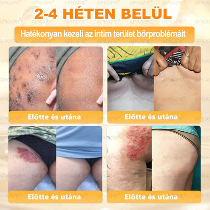 🌿𝐏𝐮𝐫𝐚𝐂𝐮𝐫𝐞® 𝐌é𝐡𝐦é𝐫𝐞𝐠 𝐁ő𝐫 𝐇𝐞𝐥𝐲𝐫𝐞á𝐥𝐥í𝐭ó 𝐊𝐫é𝐦 (𝐂𝐄 𝐓𝐚𝐧ú𝐬í𝐭𝐯á𝐧𝐲)👍✅